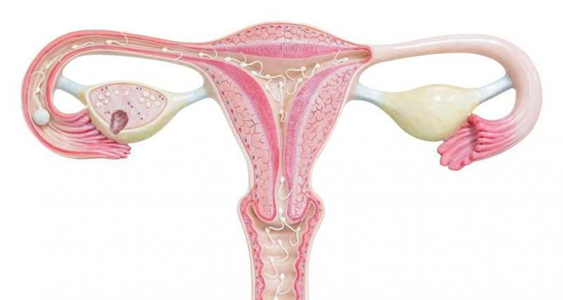 Yumurtalık Kistleri